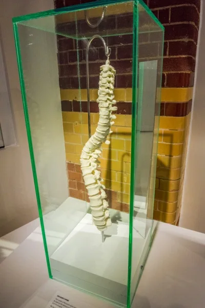A recreation of Richard's curved spine
