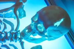 Richard III Centre, 3D model of Richard III's skull showing his death wounds